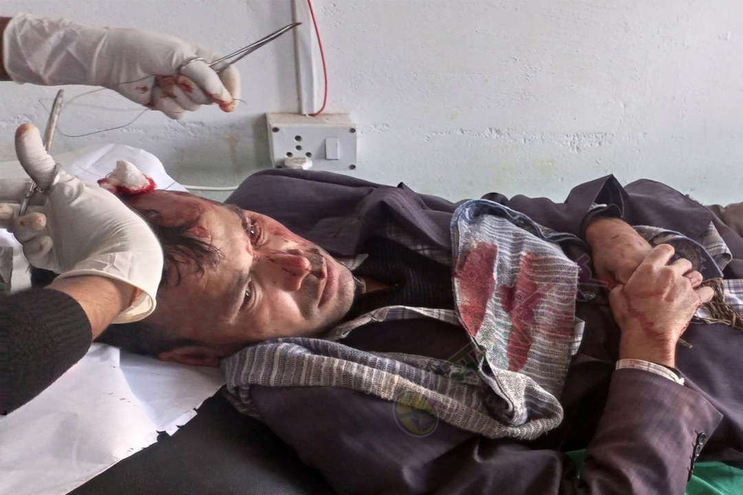 बैतडीको मेलौली अस्पताल विवाद : दुई पक्षबीच झडप, ३५ जना घाइते 